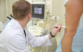 Varicose Varicose Veins Treatment Methods in Women on Legs