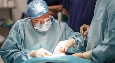 surgical treatment of varicoosis