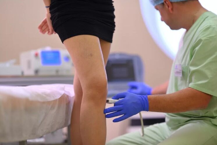 ultrasound diagnostics of varicose veins