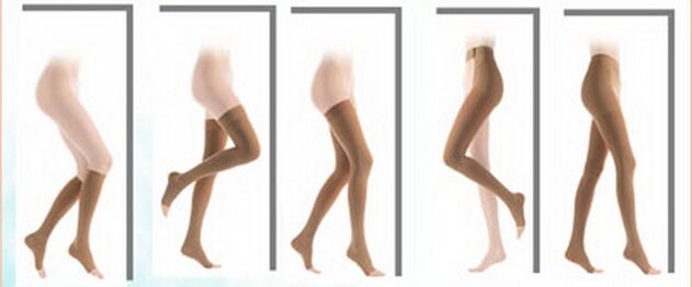 Types of compression stockings for varicose veins